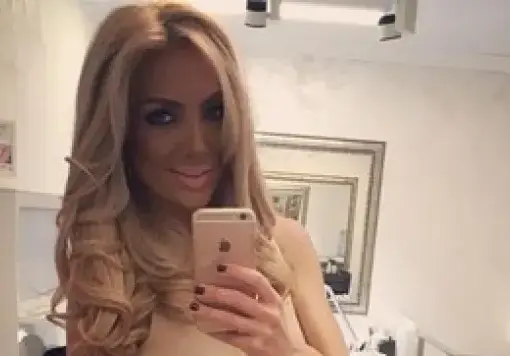 Златка Райкова пъпчаса oт солариум