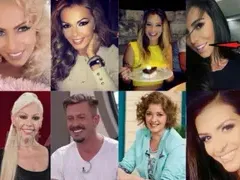 Топ 9 на звездите с изкуствени зъби! Ето кои ВИП персони блестят с фейк ченета