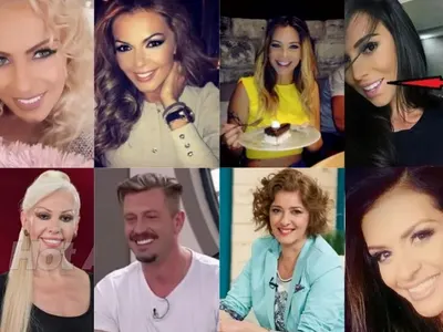 Топ 9 на звездите с изкуствени зъби! Ето кои ВИП персони блестят с фейк ченета