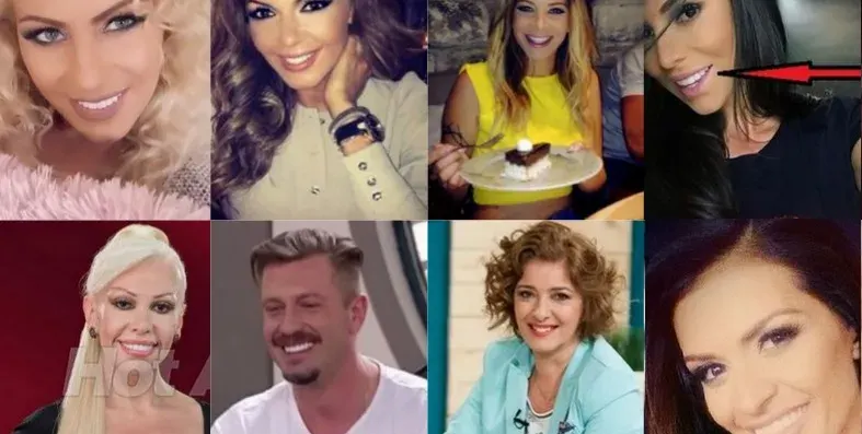 Топ 9 на звездите с изкуствени зъби! Ето кои ВИП персони блестят с фейк ченета