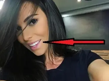 Топ 9 на звездите с изкуствени зъби! Ето кои ВИП персони блестят с фейк ченета