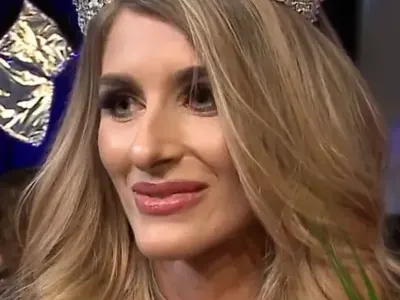 РЕКОРД! Новият нос на Тамара удари 20 бона! (+ Къде Мис България си направи пластиката)