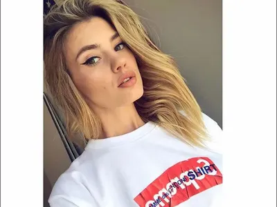 Турски хирурзи възстановяват краката на Кристин след катастрофата