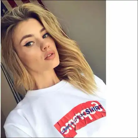 Турски хирурзи възстановяват краката на Кристин след катастрофата