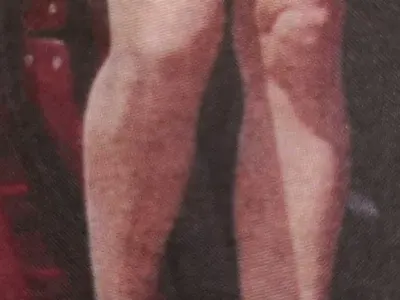 Нора Недкова нацепена от целулит! (Фото)