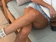 Ивайла Бакалова позира с белега си (Вижте по-долу 25-сантиметровата рана)