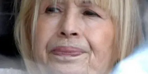 Лили едва не умря след операция! Лежи дни наред в реанимация след опит да отслабне с изрязване на мазнини