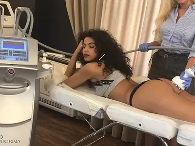 Изсмукаха целулита от дупето на Алекс