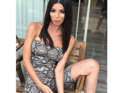 МЕГЗ със зверски синини по краката! Бита ли е дизайнерката?