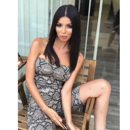 МЕГЗ със зверски синини по краката! Бита ли е дизайнерката?