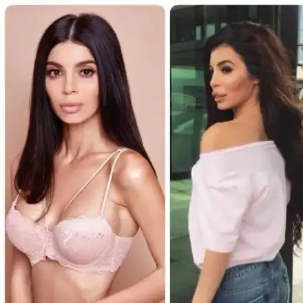 МЕГЗ изсмука силикона от лицето си (СНИМКИ)