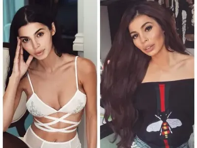 МЕГЗ изсмука силикона от лицето си (СНИМКИ)