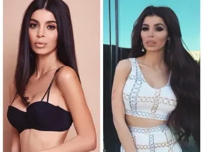 МЕГЗ изсмука силикона от лицето си (СНИМКИ)