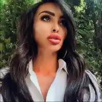 Устните на Биляна Дол ще се пръснат