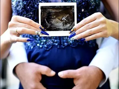 Антония Петрова чака момченце