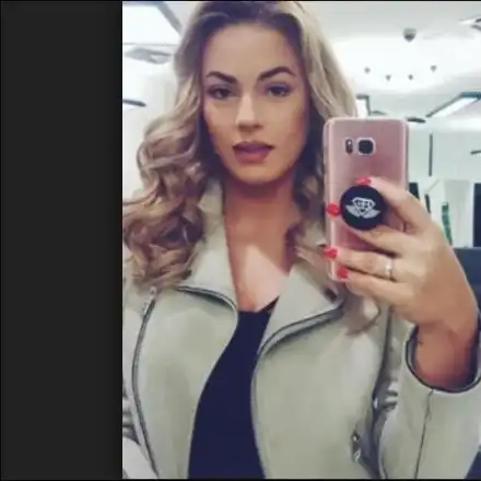 Жени Джаферович маха излишната кожа с операция