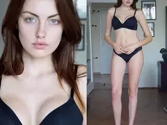Мис България от Елин Пелин си сложи силикон