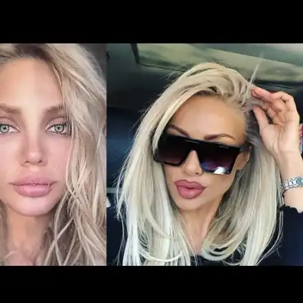 Златка копира устните на Есмер! Заради новата тъмна грива още повече я сравняват с другата