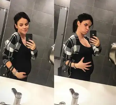 Акне мъчи Мона Гочева! Ето на какви затруднени я подлага бременността