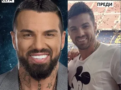 Благо Джизъса стана за смях пред цяла България с изкуственото си чене! Той ли е човекът с най-големите зъби?!