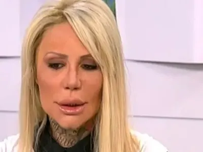 Никита Джонсън хърка като каруцар заради пластична операция