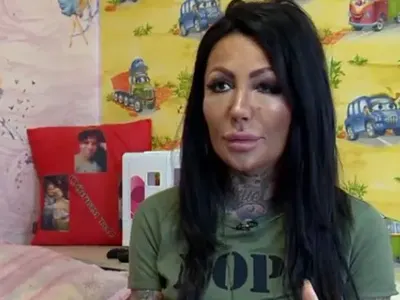 Никита се усмихва само с очи! Брадърката сама говори и разказва за обезобразяването си