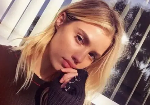 Потрошената моделка Кристин Илиева: Умирах от ужас дали ще проходя, искам само да си сгъвам крака! (Вижте най-откровената й изповед за ужаса)