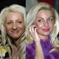 Златка била копие на тризначките преди пластичните корекции