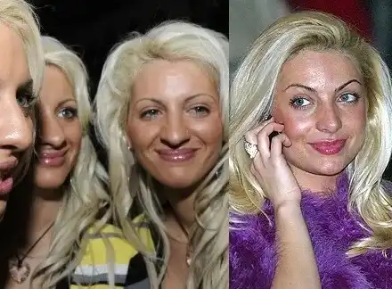 Златка била копие на тризначките преди пластичните корекции