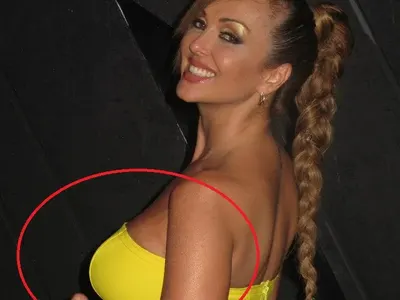 Глория сменя силикона на аванта, минава основен ремонт срещу реклама