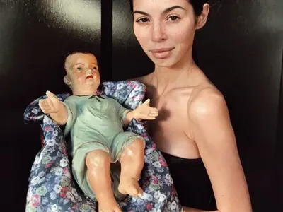 МЕГЗ представи младенеца като дете с увреждания