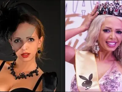 Мис Плеймейт Жанет Осипова неузнаваема преди пластиките