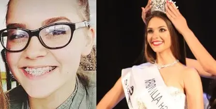 Новата Мис България имала криви зъби! Теодора била пухкаво хлапе с цайси