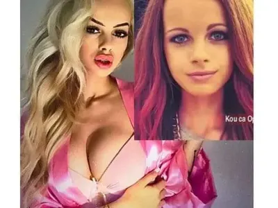 Кой с годините, кой с операции: Вижте как Емилия, Галена, Преслава, Гери-Никол и други промениха външността си!