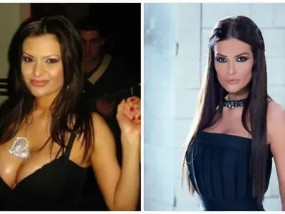 Кой с годините, кой с операции: Вижте как Емилия, Галена, Преслава, Гери-Никол и други промениха външността си!