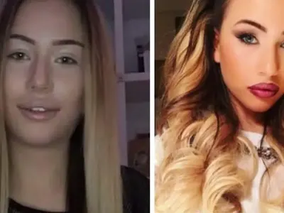 Кой с годините, кой с операции: Вижте как Емилия, Галена, Преслава, Гери-Никол и други промениха външността си!