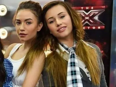 Кой с годините, кой с операции: Вижте как Емилия, Галена, Преслава, Гери-Никол и други промениха външността си!