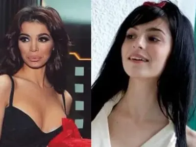 Кой с годините, кой с операции: Вижте как Емилия, Галена, Преслава, Гери-Никол и други промениха външността си!