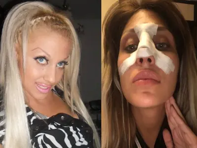 Джулиана Гани със Синдром на Квазимодо?