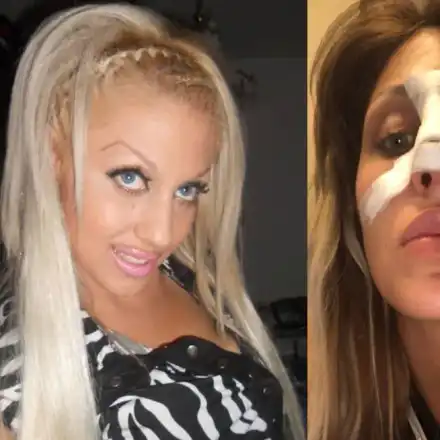 Джулиана Гани със Синдром на Квазимодо?