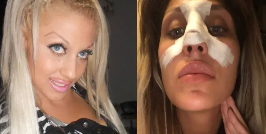 Джулиана Гани със Синдром на Квазимодо?