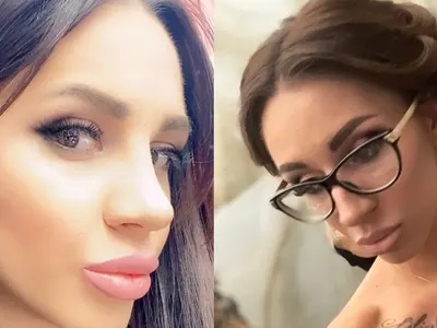 Мис Силикон е неузнаваема! Виктория Петрова си клъцна носа в Турция (Снимки)