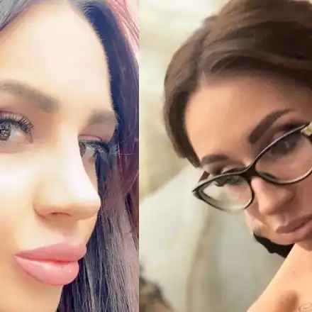 Мис Силикон е неузнаваема! Виктория Петрова си клъцна носа в Турция (Снимки)