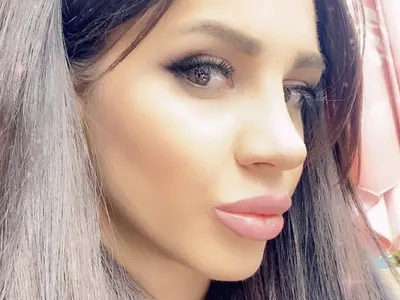 Мис Силикон е неузнаваема! Виктория Петрова си клъцна носа в Турция (Снимки)