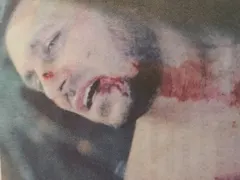 Пребиха Коцето!