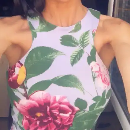 МЕГЗ си оправи захапката! Вижте новата ѝ усмивка