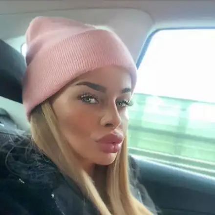 Сузанита наду устни (Фото)