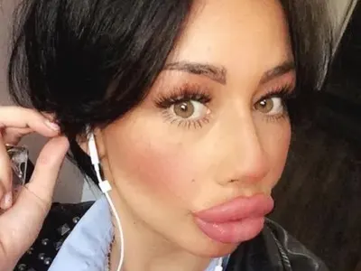 Вижте жените с най — грозните устни в света (ШОК СНИМКИ)