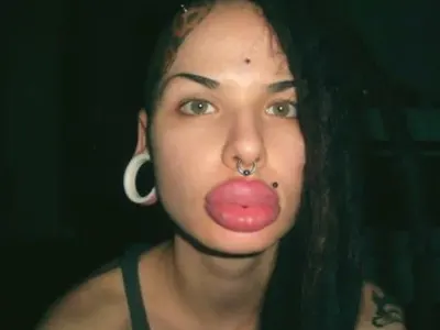 Вижте жените с най — грозните устни в света (ШОК СНИМКИ)