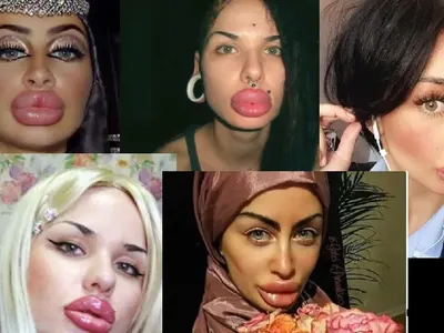 Вижте жените с най — грозните устни в света (ШОК СНИМКИ)